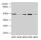 Farnesyltransferase, CAAX Box, Beta antibody, LS-C395707, Lifespan Biosciences, Western Blot image 