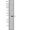 Testis Specific Serine Kinase 3 antibody, PA5-67856, Invitrogen Antibodies, Western Blot image 