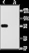 Potassium Voltage-Gated Channel Subfamily A Member 2 antibody, GTX54835, GeneTex, Western Blot image 