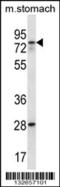Polypeptide N-Acetylgalactosaminyltransferase 17 antibody, 56-889, ProSci, Western Blot image 