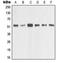 Matrix Metallopeptidase 1 antibody, LS-C352518, Lifespan Biosciences, Western Blot image 