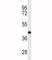 MCL1 Apoptosis Regulator, BCL2 Family Member antibody, F43180-0.4ML, NSJ Bioreagents, Western Blot image 