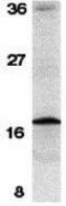 Baculoviral IAP Repeat Containing 5 antibody, GTX31653, GeneTex, Western Blot image 