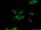 Chromodomain Helicase DNA Binding Protein 4 antibody, 66222-1-Ig, Proteintech Group, Immunofluorescence image 