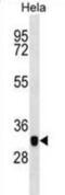 Capping Actin Protein, Gelsolin Like antibody, abx028565, Abbexa, Western Blot image 