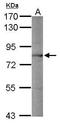 Neuroendocrine convertase 1 antibody, GTX113797, GeneTex, Western Blot image 