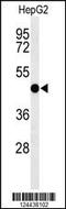 Sphingomyelin Synthase 2 antibody, MBS9201412, MyBioSource, Western Blot image 