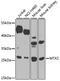 Metaxin 2 antibody, GTX33333, GeneTex, Western Blot image 