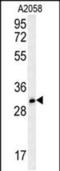 Tripartite Motif Containing 73 antibody, PA5-48650, Invitrogen Antibodies, Western Blot image 
