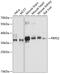 Phosphoribosyl Pyrophosphate Synthetase 2 antibody, GTX66111, GeneTex, Western Blot image 