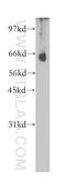 CCR4-NOT Transcription Complex Subunit 4 antibody, 12564-1-AP, Proteintech Group, Western Blot image 