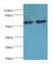 Cytochrome P450 Family 4 Subfamily F Member 12 antibody, LS-C379385, Lifespan Biosciences, Western Blot image 