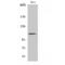 Integrin Subunit Beta 3 antibody, LS-C381129, Lifespan Biosciences, Western Blot image 