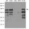 Partner And Localizer Of BRCA2 antibody, LS-C796567, Lifespan Biosciences, Western Blot image 