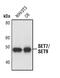 SET Domain Containing 7, Histone Lysine Methyltransferase antibody, PA5-17317, Invitrogen Antibodies, Western Blot image 