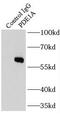 Calcium/calmodulin-dependent 3 ,5 -cyclic nucleotide phosphodiesterase 1A antibody, FNab06249, FineTest, Immunoprecipitation image 