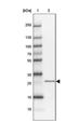 Phospholipase A2 Group V antibody, NBP2-31558, Novus Biologicals, Western Blot image 