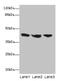 Interleukin 2 Receptor Subunit Gamma antibody, CSB-PA011651EA01HU, Cusabio, Western Blot image 