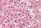 Cathepsin L antibody, MBS245445, MyBioSource, Immunohistochemistry frozen image 