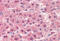 Cathepsin L antibody, MBS245445, MyBioSource, Immunohistochemistry frozen image 