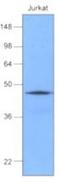 DnaJ Heat Shock Protein Family (Hsp40) Member B1 antibody, NBP1-04302, Novus Biologicals, Western Blot image 