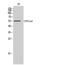 Cytochrome P450 Family 21 Subfamily A Member 2 antibody, STJ92561, St John