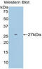 DIX Domain Containing 1 antibody, MBS2003711, MyBioSource, Western Blot image 