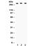 ATP Binding Cassette Subfamily A Member 1 antibody, R31847, NSJ Bioreagents, Western Blot image 