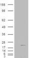 Cofilin 2 antibody, GTX89482, GeneTex, Western Blot image 