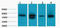 Lactate Dehydrogenase D antibody, STJ97199, St John