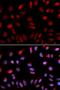 Potassium voltage-gated channel subfamily H member 5 antibody, orb334759, Biorbyt, Immunofluorescence image 