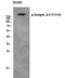 Integrin Subunit Beta 4 antibody, A01015Y1510, Boster Biological Technology, Western Blot image 