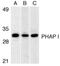 Acidic Nuclear Phosphoprotein 32 Family Member A antibody, PA1-30728, Invitrogen Antibodies, Western Blot image 