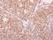 IFI30 Lysosomal Thiol Reductase antibody, NBP1-32466, Novus Biologicals, Immunohistochemistry frozen image 