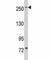 Leucine Rich Repeat Kinase 1 antibody, F40142-0.4ML, NSJ Bioreagents, Western Blot image 