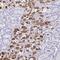 Tryptase Gamma 1 antibody, NBP2-37977, Novus Biologicals, Immunohistochemistry frozen image 