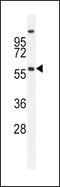 Bone Morphogenetic Protein 4 antibody, MBS9212453, MyBioSource, Western Blot image 