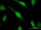 CTD Phosphatase Subunit 1 antibody, H00009150-M04, Novus Biologicals, Immunofluorescence image 