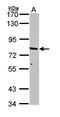 ATP Binding Cassette Subfamily D Member 2 antibody, orb74085, Biorbyt, Western Blot image 