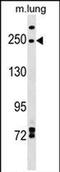 Inverted Formin, FH2 And WH2 Domain Containing antibody, PA5-72011, Invitrogen Antibodies, Western Blot image 