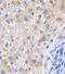Glutathione Peroxidase 4 antibody, FNab03622, FineTest, Immunohistochemistry paraffin image 