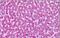 Glutamate Metabotropic Receptor 7 antibody, NLS917, Novus Biologicals, Immunohistochemistry paraffin image 