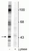 EPH Receptor B2 antibody, P01507-1, Boster Biological Technology, Western Blot image 