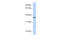 Transmembrane Protein 200B antibody, 25-962, ProSci, Western Blot image 