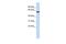 Gamma-Aminobutyric Acid Type A Receptor Beta3 Subunit antibody, PA5-41056, Invitrogen Antibodies, Western Blot image 