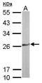 Thiamin pyrophosphokinase 1 antibody, PA5-27970, Invitrogen Antibodies, Western Blot image 