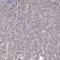 Phenylalanyl-TRNA Synthetase Subunit Beta antibody, PA5-63954, Invitrogen Antibodies, Immunohistochemistry frozen image 
