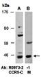 Denticleless E3 Ubiquitin Protein Ligase Homolog antibody, orb67183, Biorbyt, Western Blot image 