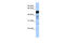 RAD18 E3 Ubiquitin Protein Ligase antibody, 29-851, ProSci, Enzyme Linked Immunosorbent Assay image 