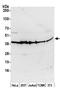 Casein Kinase 2 Alpha 1 antibody, GTX10474, GeneTex, Western Blot image 